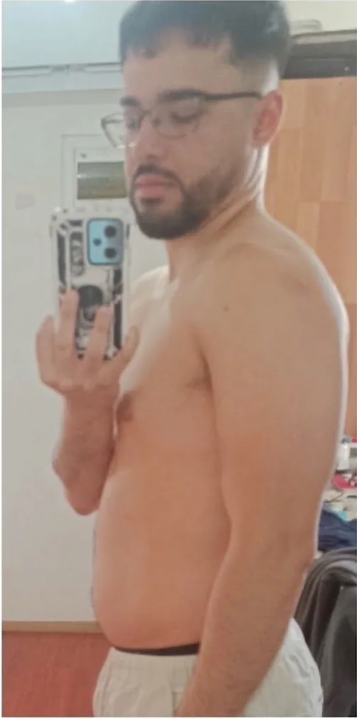 Antes